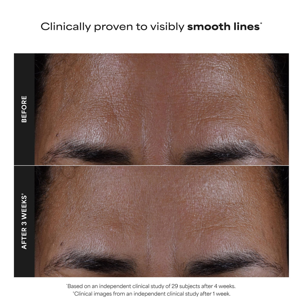 Paula's Choice SKIN PERFECTING 2% BHA Liquid Exfoliant with Salicylic Acid, Facial Polish for Pores, Wrinkles & Fine Lines, Suitable for Blackhead-Prone Skin, Fragrance-Free
